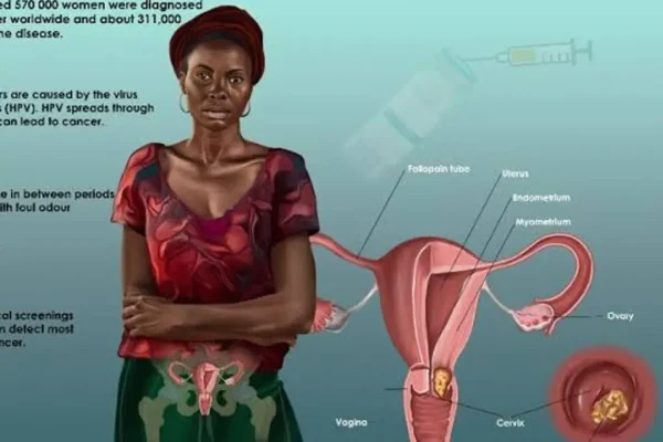 Cervical Cancer Awareness in Nigeria